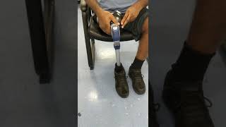 Tips for putting on your above knee SealIn suction socket prosthesis [upl. by Docilla537]