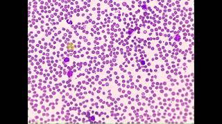 Crenated RBCs WBCs Pig Blood smear [upl. by Edroi347]