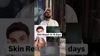 Skin repair in 15 days [upl. by Dolphin983]