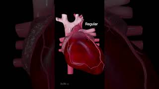 Heart Arrhythmias Different Types and Symptoms [upl. by Gnep485]