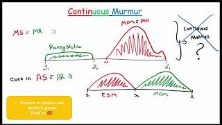 Cardiac MURMUR  Part2 Systolic and Continuous murmur Focused on FMGENEXT amp NEETPG [upl. by Rentsch]