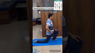 Exercise for Hyper lumbar Lordosis Lumbar lordosis lumbarlordosis posturecorrection [upl. by Akeylah296]