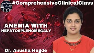 Anemia with Hepatosplenomegaly Case presentation [upl. by Maillij]