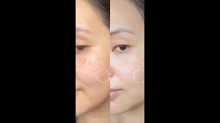 My night time skin care routine using Faded topicals Brightening and Clearing Serum [upl. by Roy]