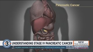 Understanding stage IV pancreatic cancer [upl. by Akemej]