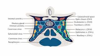 Cerebral Venous Thrombosis  Neurology section 2 Magnetic Resonance Venography [upl. by Cirde]