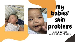 Vlogmas 9  Products for Atopic Dermatitis in Babies [upl. by Audrey]