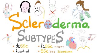 Scleroderma Subtypes 5 Types of Systemic Sclerosis incl Limited vs Diffuse Scleroderma [upl. by Ati]