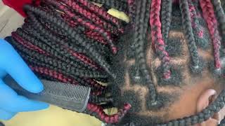 ASMR Scalp Scratching before undo my braids to help you relax and sleep [upl. by Haon312]