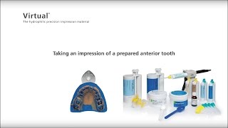 Virtual – Taking an impression of a prepared anterior tooth [upl. by Herzig]