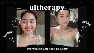 Smaller Face How To Celebrity Secret Tips  Ultherapy Before amp After Procedure  Stara Paredes 🤩 [upl. by Trocki177]