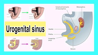 urogenital sinus [upl. by Urbai]