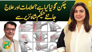 Chikungunya Fever amp Joint Pain  Remedies By Hakeem Shah Nazir  Aaj Pakistan [upl. by Annia]