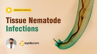 Tissue Nematode Infections  Medicine Lectures  Medical Student Online  VLearning [upl. by Annaiuq241]