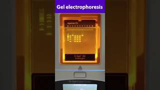 Gel electrophoresis Technique [upl. by Htinek836]