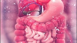 Intestinal obstruction part 2 and Benign tumor of intestine [upl. by Narod2]