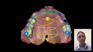 Intraoral scanning technique with Primescan Scan pattern for best accuracy [upl. by Waylen288]