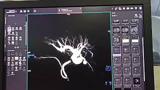 MRCP sequence [upl. by Enehpets]