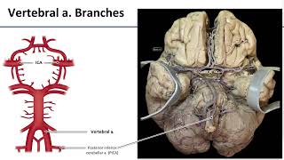 LO5 Arterial Supply to Brain [upl. by Geldens201]