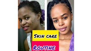 Skin Before amp After Skin Care Routine Shaz The Dietitian [upl. by Powers325]