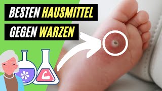 ✅ Warzen entfernen mit Hausmitteln  5 hilfreiche TIPPS gegen Warzen [upl. by Serrano626]