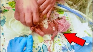 Mom Gave Birth After Just 5 Months She Looks At Her Baby And Sees THIS [upl. by Eissirc376]