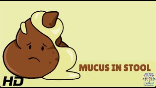 Mucus In Stool Everything You Need To Know [upl. by Jonette]