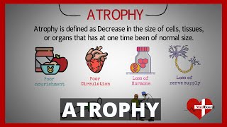 Atrophy Types and Causes Made Easy  What is atrophy [upl. by Gardel]