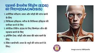 Ehler Danlos Syndrome Ke Symptoms aur Treatment [upl. by Morril]