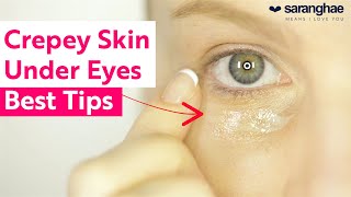 Crepey Skin Under The Eyes Top Tips To Help [upl. by Brady273]