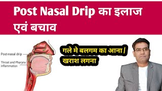 What is Post Nasal Drip its Cause Symptoms and Treatment Explained in Hindi [upl. by Ssitruc398]