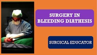 SURGERY IN BLEEDING DIATHESIS [upl. by Gauntlett]