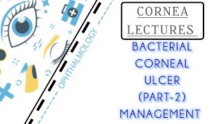 CORNEA LECTURE 4 MANAGEMENT OF BACTERIAL CORNEAL ULCER [upl. by Acinnod334]