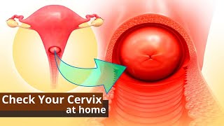 How You Can Check Your Cervix At Home  Best Ways to Know the Dilation of Cervix [upl. by Yasmin]