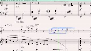 Sibelius 6 Quick Tip 4 Creating Ornaments [upl. by Llevert]