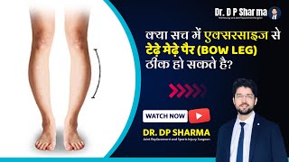 Can Bow Legs Be Corrected With Exercises Bow Legs Correction In Delhi NCR amp Agra  Dr DP Sharma [upl. by Kire]