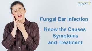 Causes Symptoms and Treatment of Fungal Ear Infection [upl. by Erapsag]