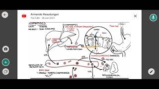 hemochromatosis [upl. by Prue]