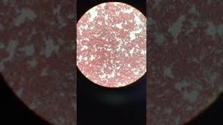 Heartworm microfilaria blood smear [upl. by Duomham304]