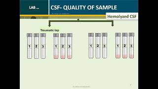 Cerebrospinal fluid Routine Analysis Microbiology Tube 2 [upl. by Doralyn]