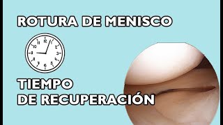 Tiempos de recuperación tras una rotura de MENISCO [upl. by Otnicaj733]