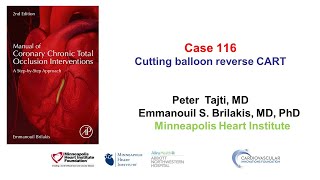 Case 116 Manual of CTO Interventions Cuttingballoon assisted reverse CART [upl. by Ettevey315]