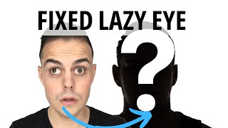 Lazy Eye Fixed amblyopia strabismus [upl. by Constantia]