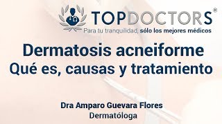 Dermatosis acneiforme Qué es causas y tratamiento [upl. by Cela]