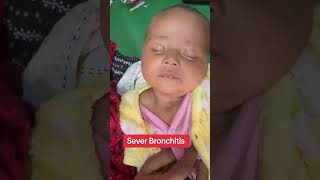 Severe Bronchitis drataurrahman newbornbaby baby crezyboy [upl. by Ahsoym]