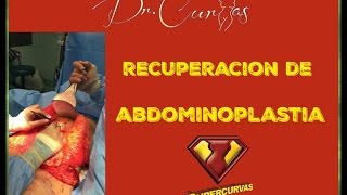 Recuperación de Abdominoplastia  Dr Cortes [upl. by Pachston]