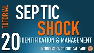 Diagnosis and Management of Septic Shock [upl. by Drogin]