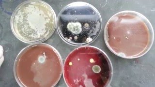 Fungal contaminated various culture plates [upl. by Rossi]