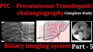 Percutaneous Transhepatic Cholangiography  PTC  Procedure  Biliary imaging system part  5 [upl. by Annahsirhc]