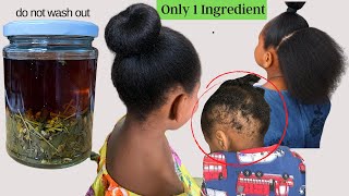 Extremely Effective Natural Remedy To Fight Hair Loss And Speed Up Hair Growth [upl. by Rosaleen985]